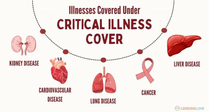 Critical Illness Cover